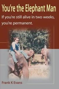 You’’re the Elephant Man: If You’’re Still Alive After Two Weeks, You’’re Permanent